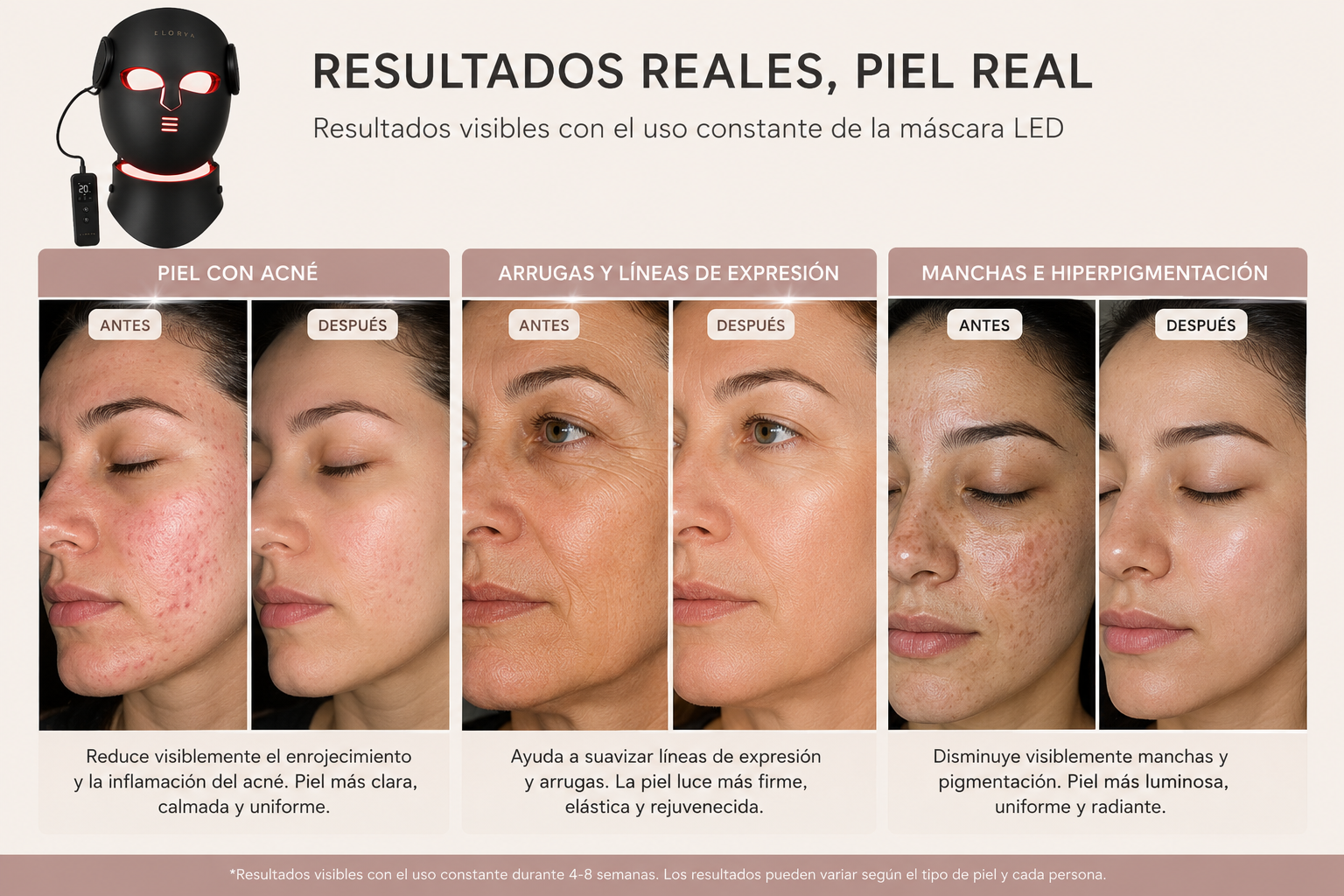 ELORYYA LED Therapy Mask Pro™